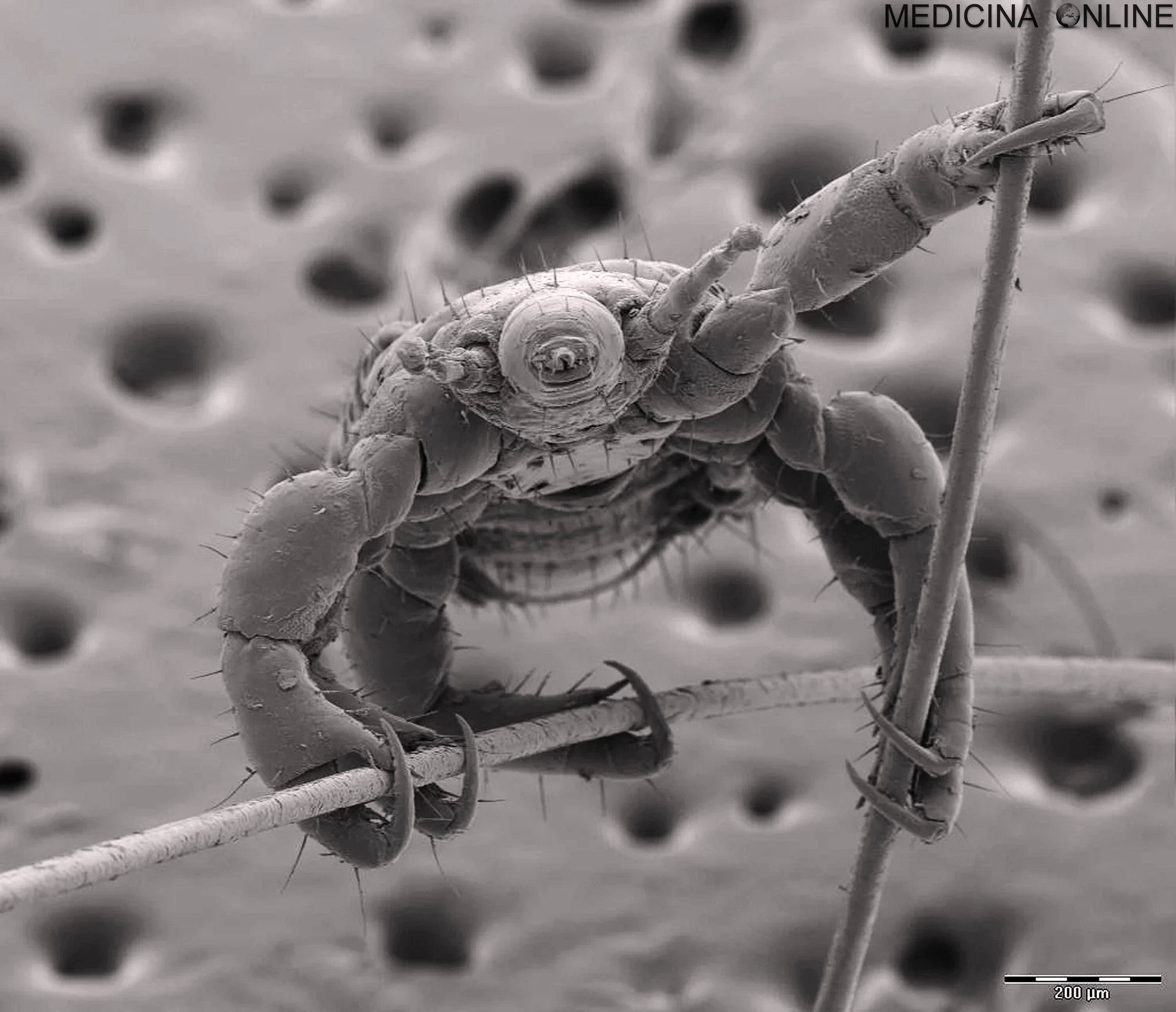 Бактерии на мухе. Тихоходка в микроскопе. Тихоходка микрофотография. Тихоходка сканирующая микроскопия. Микроробы под мекраскопам.
