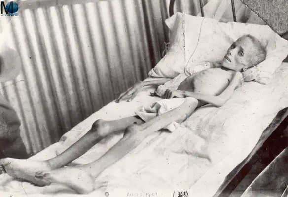 Lizzie van Zyl Dziewczynka(22 April 1894 – 9 May 1901) CAMPO DI CONCENTRAMENTO GUERRA MORTA a child inmate of Bloemfontein concentration camp died from typhoid fever during the Second Boer War. Les camps de concentration