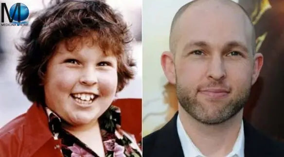 MEDICINA ONLINE GOONIES Jeff Cohen BEFORE AFTER NOW PICTURE PICS.jpg