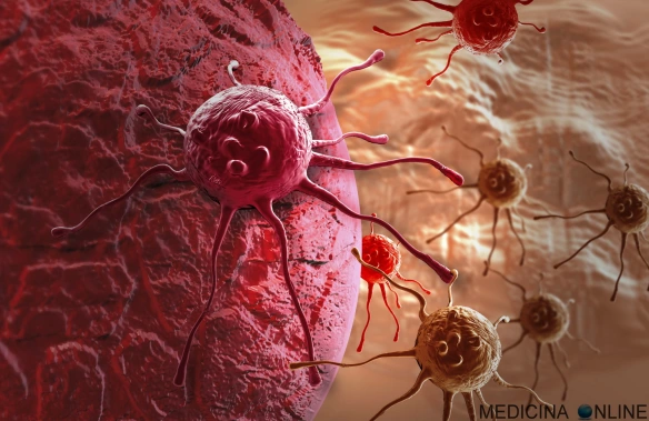 MEDICINA ONLINE TUMORE TUMOR CANCRO CANCER CELL CELLULA LEIOMIOMA TESSUTO OSSA MAMMELLA SENO TESTICOLO POLMONE METASTASI DIFFUSIONE STADIAZIONE LINFONODO SENTINELLA WALLPAPER