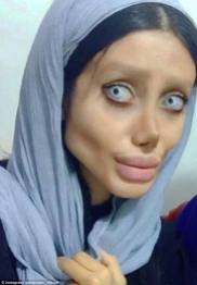 06 MEDICINA ONLINE Sahar Tabar Angelina Jolie Extreme surgery effects