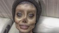 10 MEDICINA ONLINE Sahar Tabar Angelina Jolie Extreme surgery effects