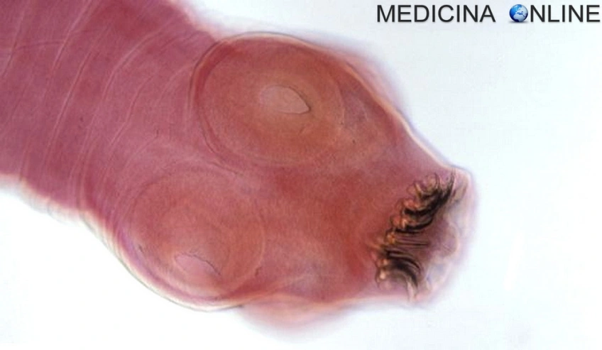 MEDICINA ONLINE TAENIA SOLIUM TENIA VERME SOLITARIO INTESTINO pork tapeworm infection