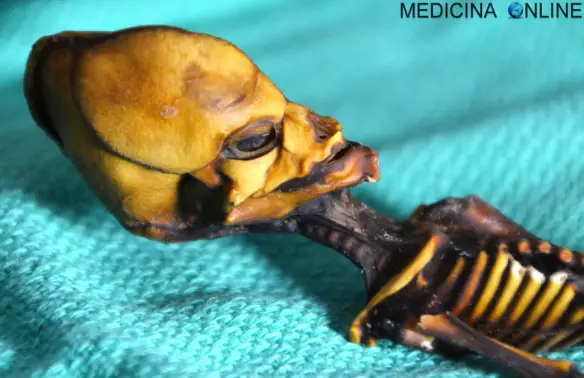 MEDICINA ONLINE ALIEN SKELETON CILE FETUS Mini-scheletro alieno scoperto in Cile svelato il mistero tramite il DNA.jpg