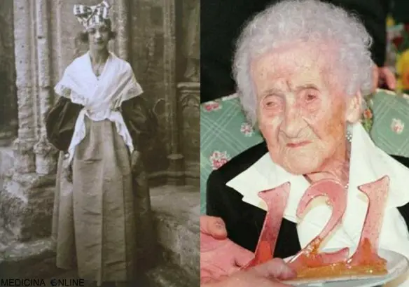 MEDICINA ONLINE 122 anni Jeanne Louise Calment ESSERE UMANO DONNA STORIA ANZIANO ETA RECORD GUINNES PRIMATO DECESSO MORTE.jpg