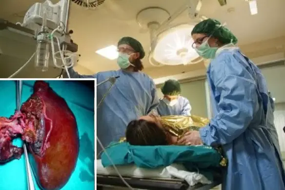 MEDICINA ONLINE Napoli, medici salvano ragazza incinta e il figlio in grembo asportato tumore.jpg