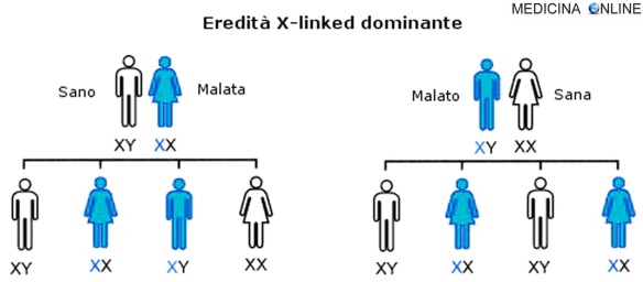 MEDICINA ONLINE Ereditarietà X linked DOMINANTE malattie legate al cromosoma X significato esempi.jpg