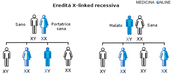 MEDICINA ONLINE Ereditarietà X linked RECESSIVA malattie legate al cromosoma X significato esempi