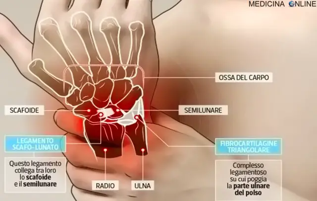 anatomia del polso con dolore