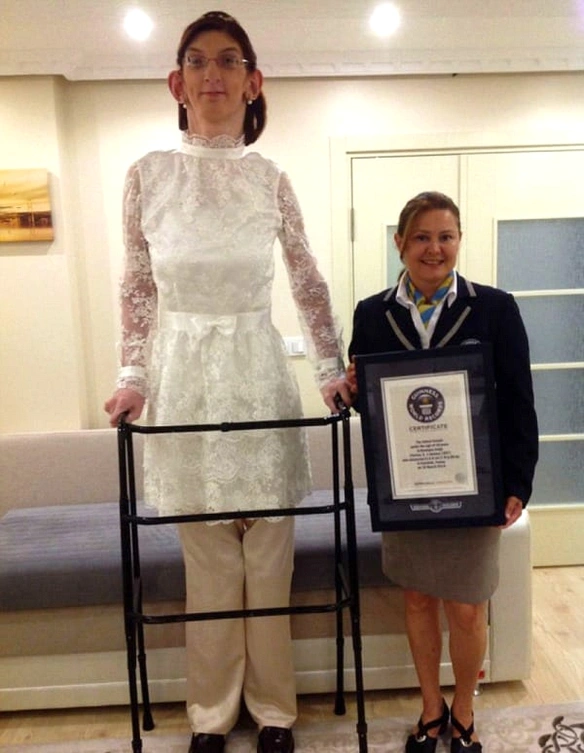 MEDICINA ONLINE EMILIO ALESSIO LOIACONO MEDICO CHIRURGO Rumeysa Gelgi è la donna più alta del mondo supera i 2 metri e 15 centimetri