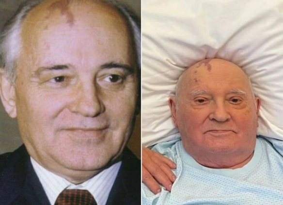 MEDICINA ONLINE EMILIO ALESSIO LOIACONO MEDICO CHIRURGO Mikhail Gorbaciov Prima Ora Before After